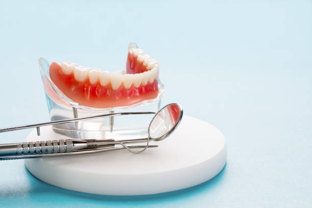 Dental Bonding in Brookdale, NJ